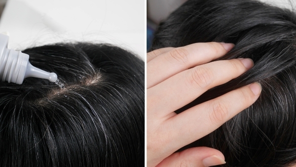 醫師建議平日應勤加頭皮保養，頭皮健康，頭髮自然烏黑亮麗