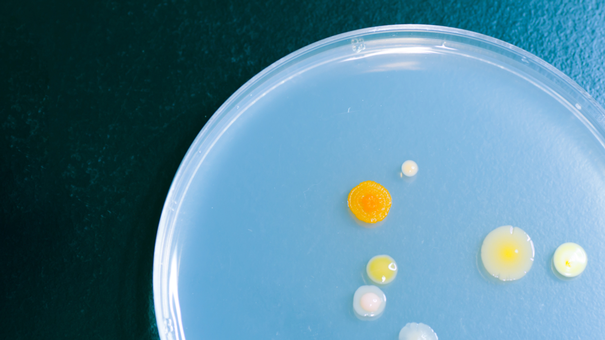 對抗伊波拉病毒的經驗教訓