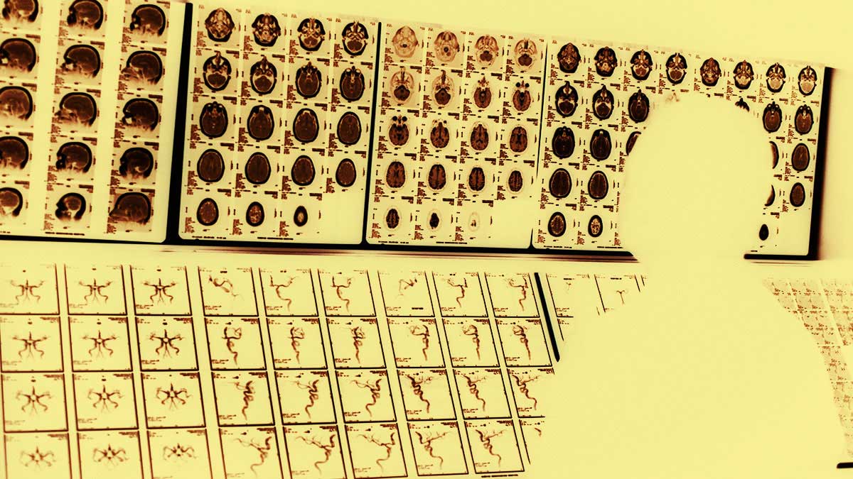 人工智慧不會取代放射科醫師